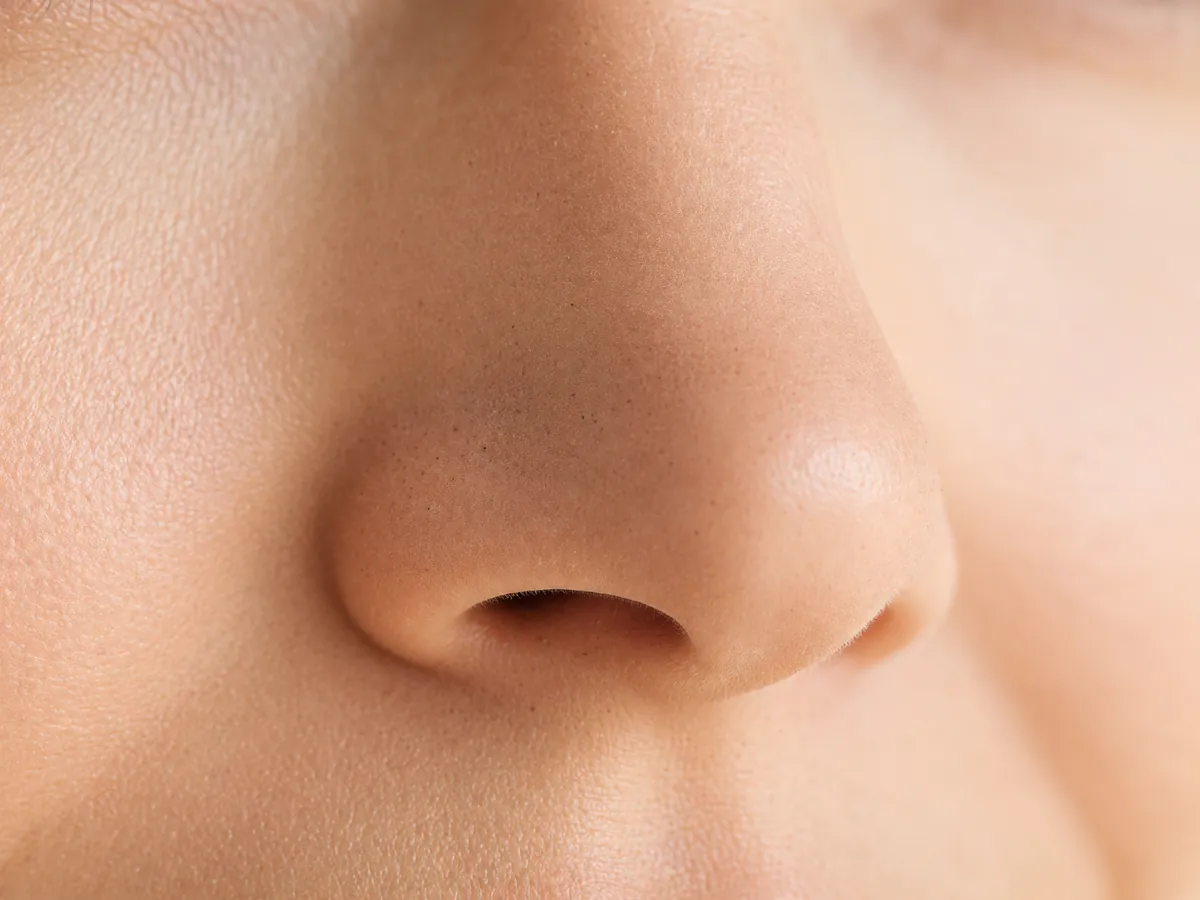 Close-up of pores on the nose