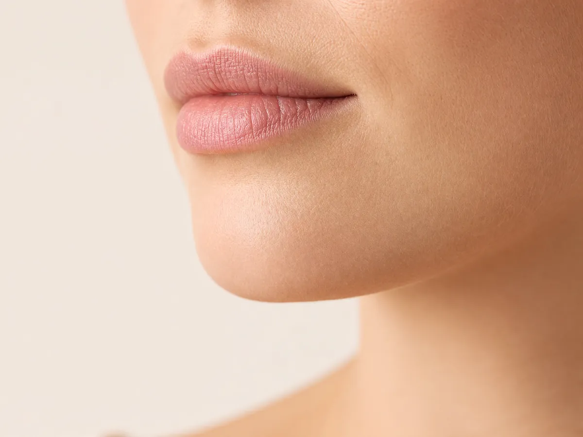 Upper lip and chin, for facial laser hair removal