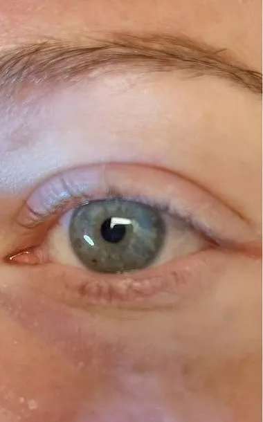 Before: Lash lift and tint at Vero Beach Medical Spa